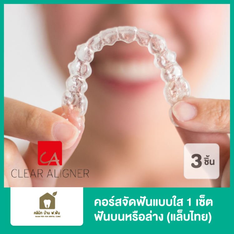 คอร์สจัดฟันแบบใส Clear Aligner 1 เซ็ต ฟันบนหรือล่าง (แล็บไทย) ที่ บ้าน ฟ. ฟัน คลินิกทันตกรรม (Baanforfun Dentistry)