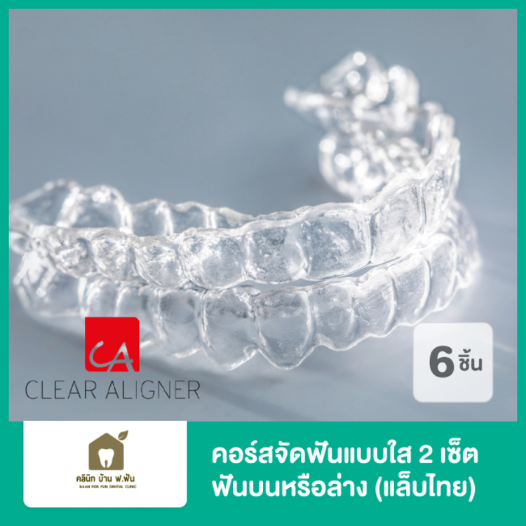 คอร์สจัดฟันแบบใส Clear Aligner 2 เซ็ต บนและล่าง (แล็บไทย) ที่ บ้าน ฟ. ฟัน คลินิกทันตกรรม (Baanforfun Dentistry)