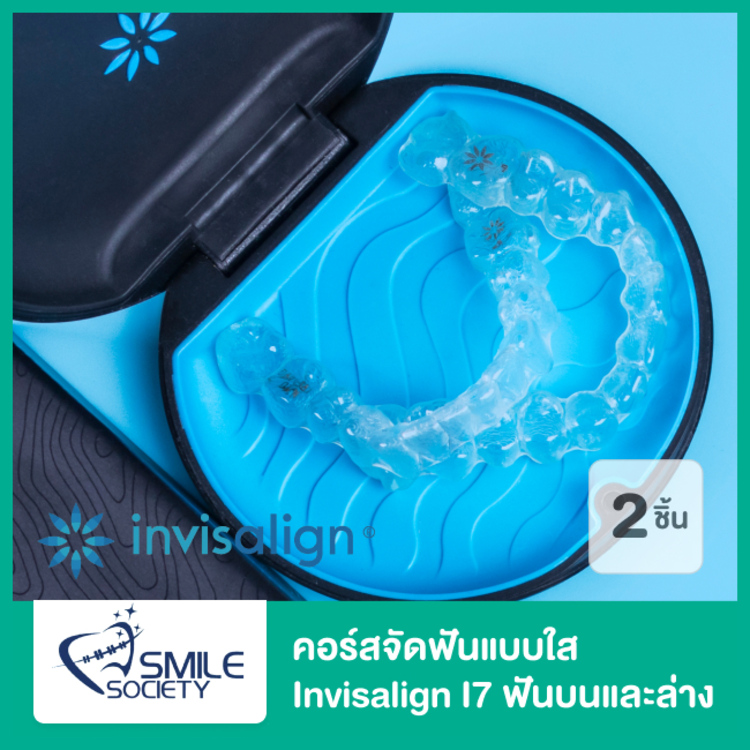 คอร์สจัดฟันแบบใส Invisalign i7 ฟันบนและล่าง ที่ Smile Society Dental (คลินิกทันตกรรมสไมล์โซไซตี้)