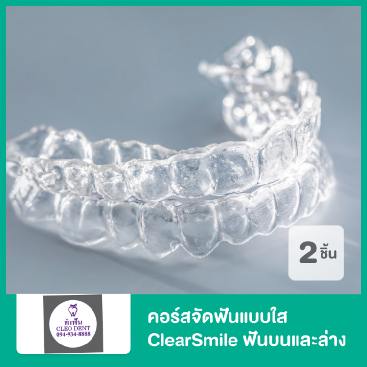 คอร์สจัดฟันแบบใส ClearSmile ฟันบนและล่าง ที่ Cleo Dent Dental Clinic