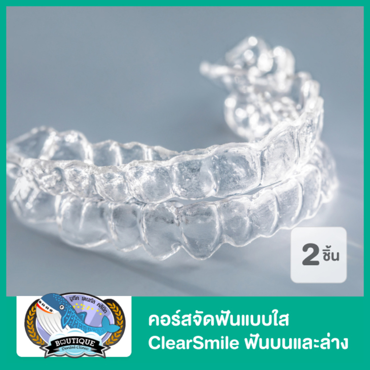 คอร์สจัดฟันแบบใส ClearSmile ฟันบนและล่าง ที่ ศูนย์จัดฟัน รากเทียม บูทีคเด็นทัล