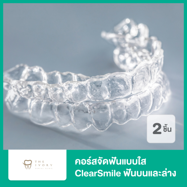 คอร์สจัดฟันแบบใส ClearSmile ฟันบนและล่าง ที่ The Ivory Dental Clinic (คลินิกทันตกรรม ดิไอวรี่)