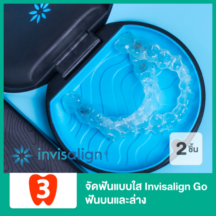 จัดฟันแบบใส Invisalign Go ฟันบนและล่าง ที่ 3D Dental Clinic