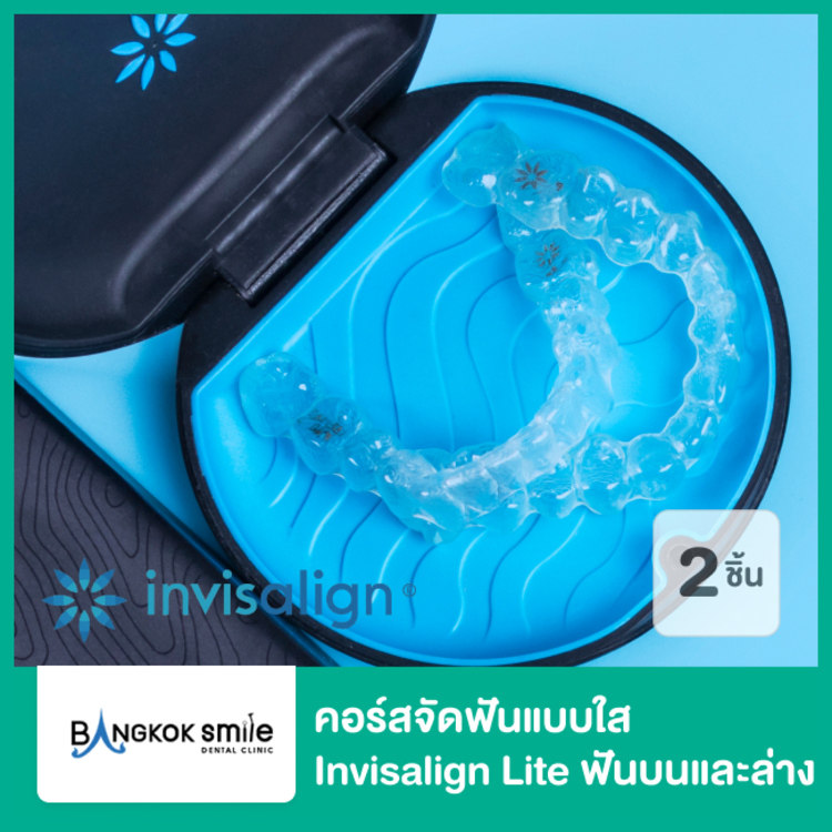 คอร์สจัดฟันแบบใส Invisalign Lite ฟันบนและล่าง ที่ Bangkok Smile Dental