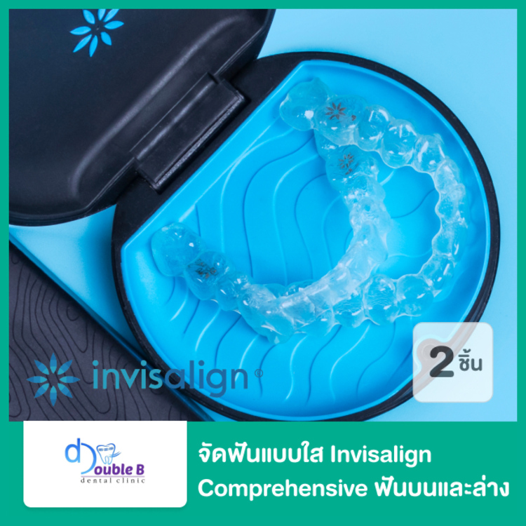 จัดฟันแบบใส Invisalign Comprehensive ฟันบนและล่าง ที่ Double B Dental Clinic