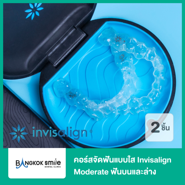 คอร์สจัดฟันแบบใส Invisalign Moderate ฟันบนและล่าง ที่ Bangkok Smile Dental