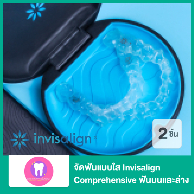 จัดฟันแบบใส Invisalign Comprehensive ฟันบนและล่าง ไม่จำกัดจำนวนเครื่องมือ ที่ Prodent Dental Clinic