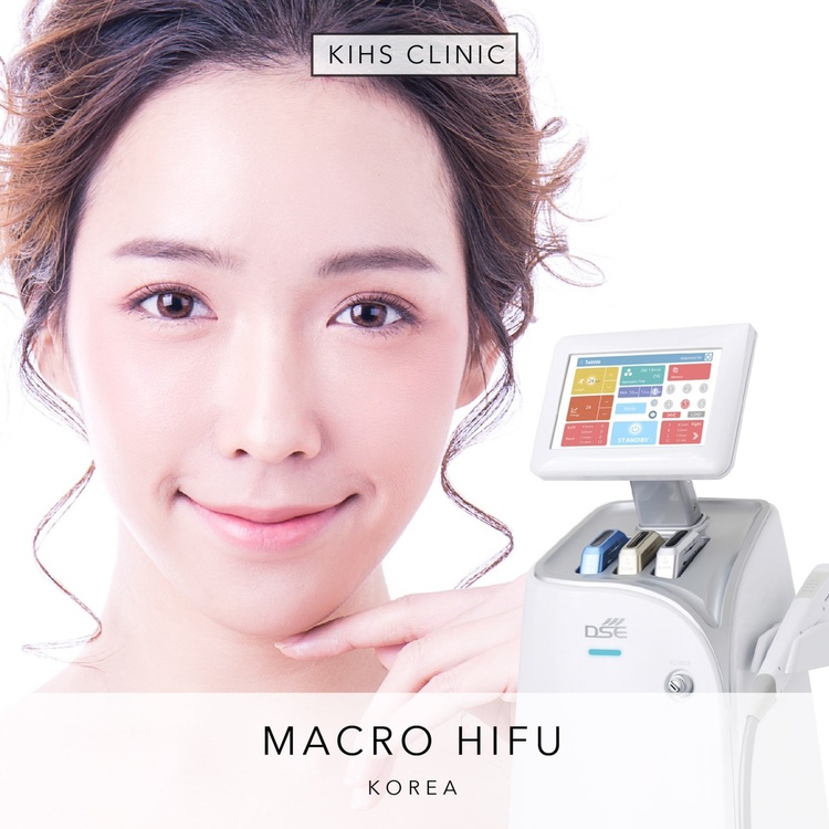 ทำ Macro HIFU ไม่จำกัดช็อต ทั่วใบหน้า รวมเหนียง 1 ครั้ง ที่ KIHS Clinic