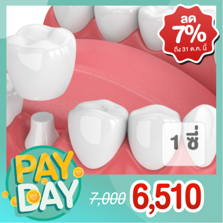 ทำครอบฟัน 1 ซี่ (เริ่มต้นที่ 7000 บาท ตามแพทย์ประเมิน) ที่ Deezy Dental Home
