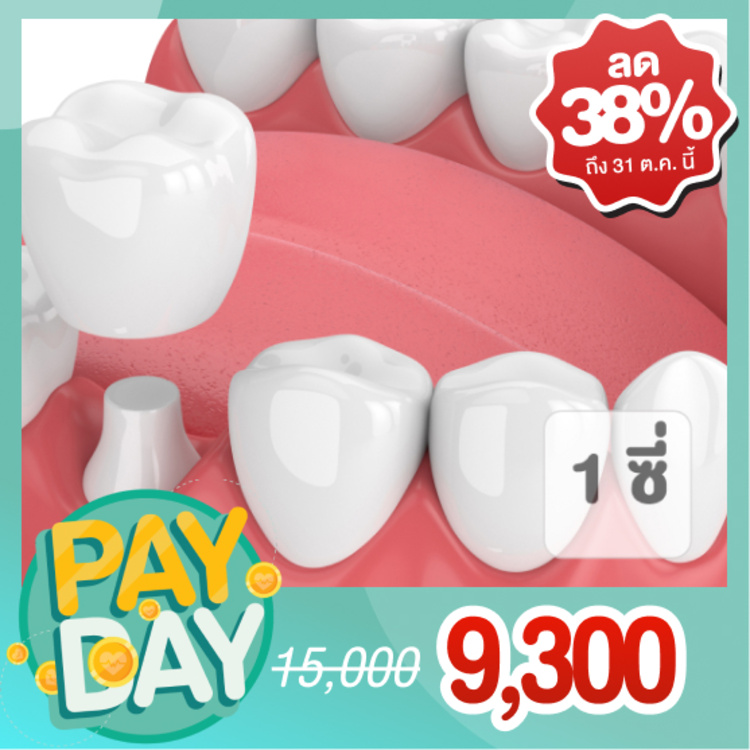 ทำครอบฟันเซอร์โคเนีย (Zirconia) 1 ซี่ (ตามแพทย์ประเมิน) ที่ Ambassador 11 Dental Clinic