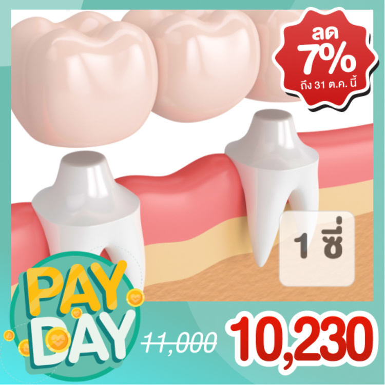 ทำสะพานฟันและครอบฟัน 1 ซี่ ที่ 3D Dental Clinic