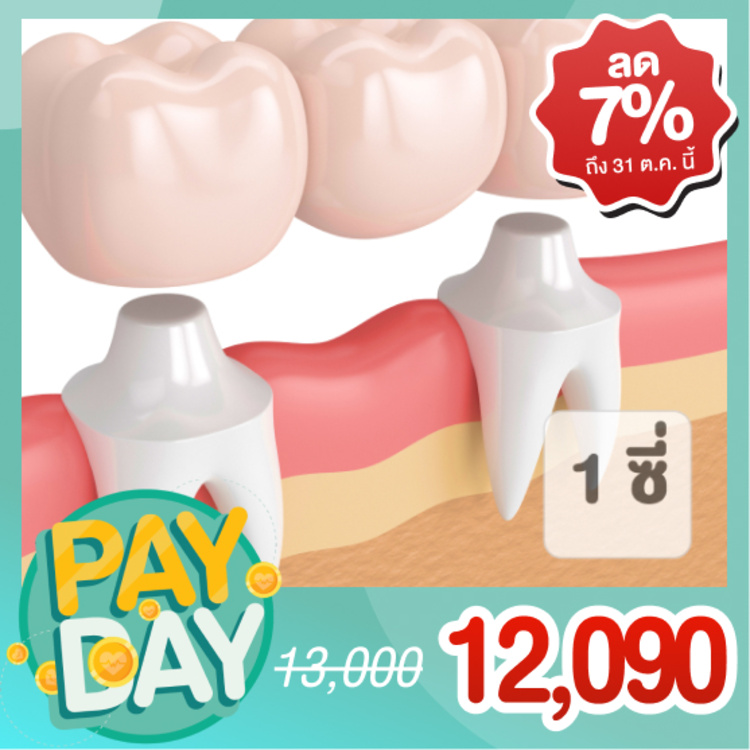 ทำสะพานฟันและครอบฟัน 1 ซี่ ที่ LDC Dental