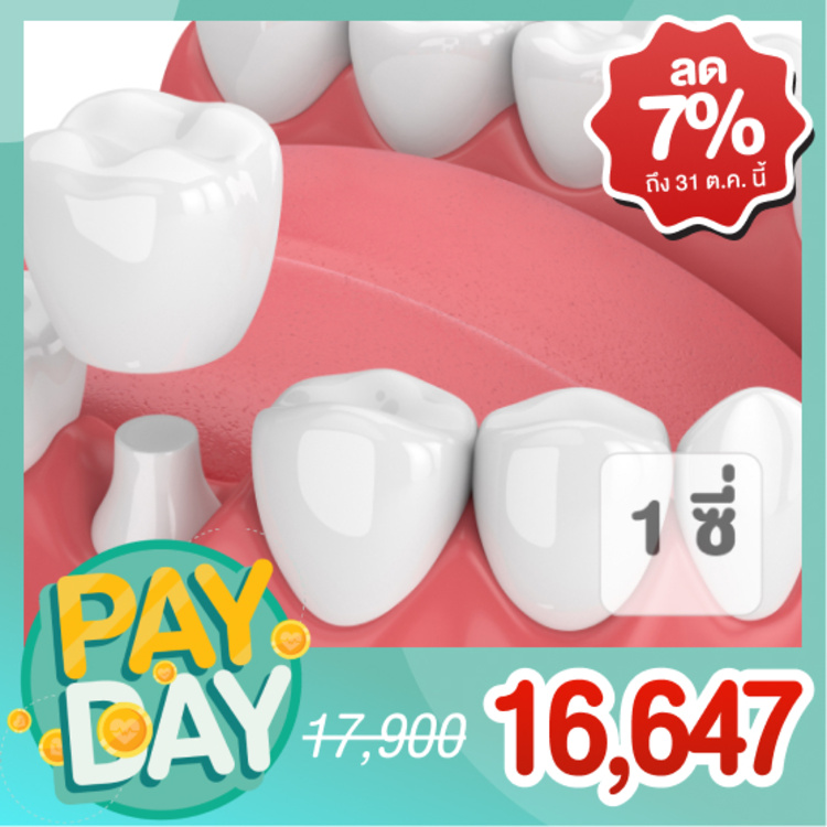 ทำครอบฟันเซอร์โคเนีย (Zirconia) 1 ซี่ ที่ บ้าน ฟ. ฟัน คลินิกทันตกรรม (Baanforfun Dentistry)