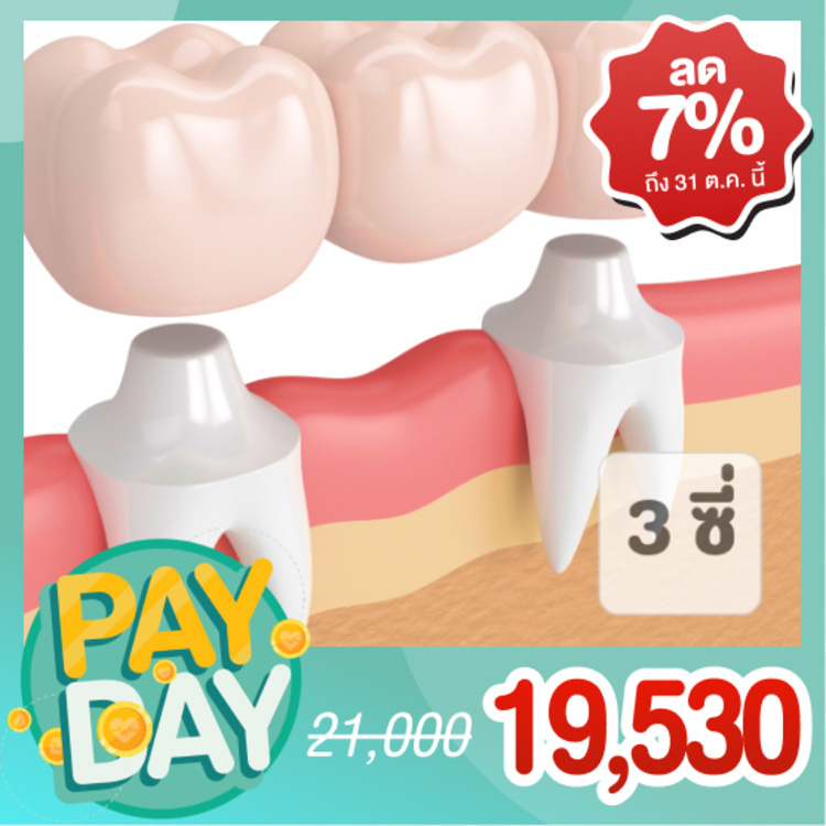 ทำสะพานฟัน (ครอบฟัน 3 ซี่) ที่ Deezy Dental Home