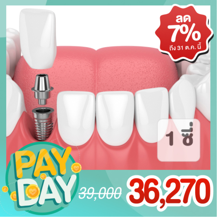 ทำรากฟันเทียม ยี่ห้อ Osstem รวมครอบฟัน 1 ซี่ ที่ คลินิกทันตกรรมแสนดี