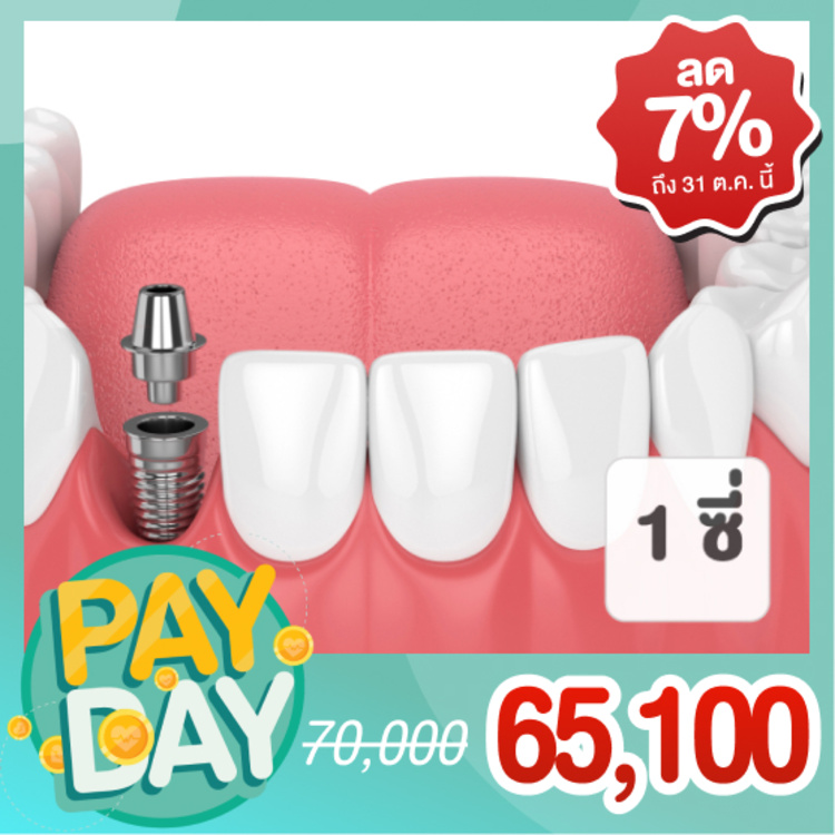 ทำรากฟันเทียม ยี่ห้อ Astra Tech 1 ซี่ ที่ CSDC