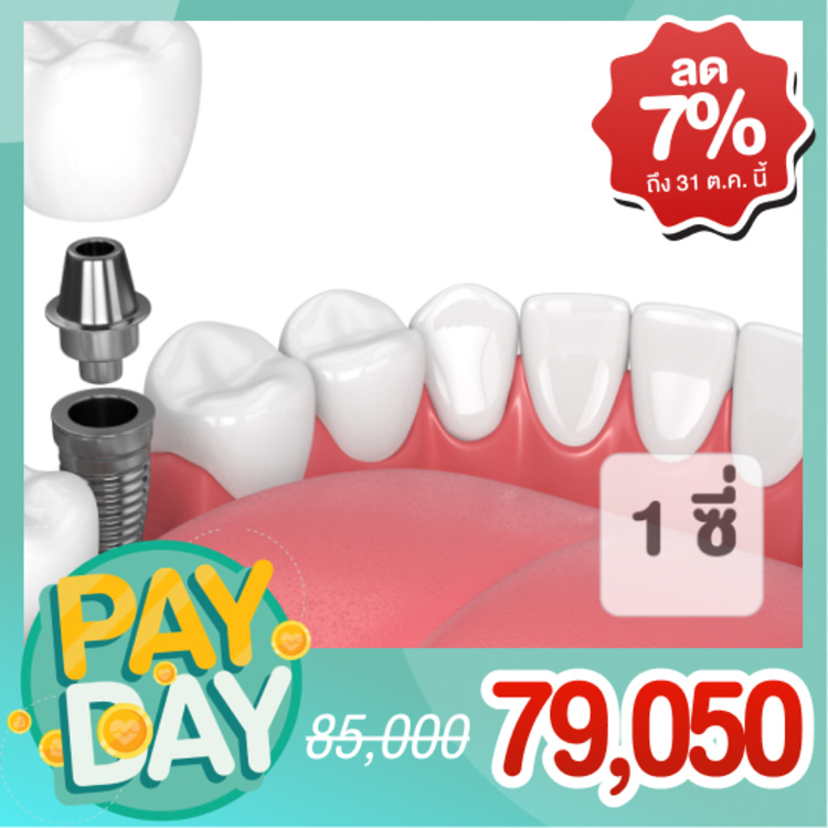 รากฟันเทียม ยี่ห้อ Straumann รวมครอบฟัน 1 ซี่ (ตามแพทย์ประเมิน) ที่ The ARCH Dental Center (ศูนย์ทันตกรรมดิอาร์ช)