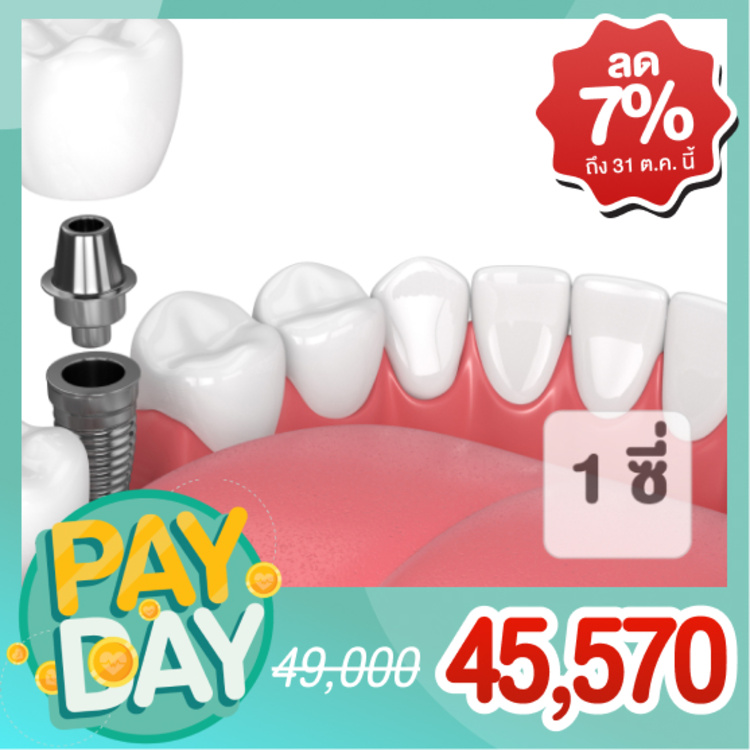 ทำรากฟันเทียม ยี่ห้อ Osstem รวมครอบฟัน 1 ซี่ (ตามแพทย์ประเมิน) ที่ The ARCH Dental Center (ศูนย์ทันตกรรมดิอาร์ช)