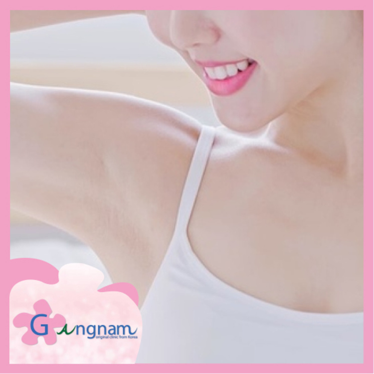 กำจัดขนรักแร้ด้วยเลเซอร์ Long Pulse Nd:YAG 1 ครั้ง ที่ Gangnam Clinic