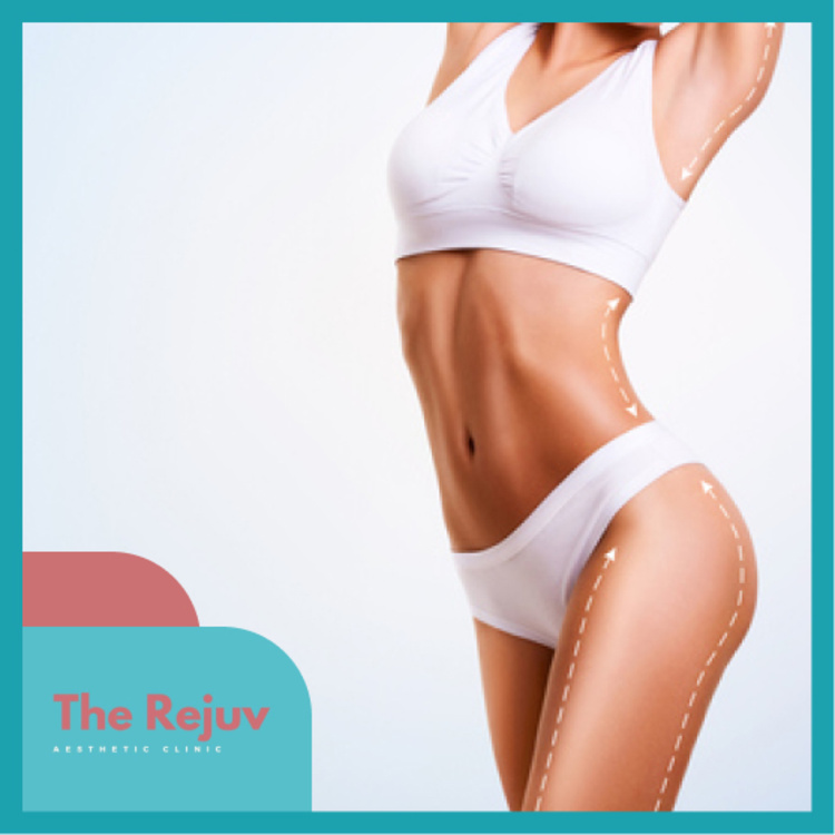 Maxslim สลายเซลลูไลท์ ด้วยคลื่นความถี่วิทยุ (RF) 1 ครั้ง ที่ The Rejuv Clinic