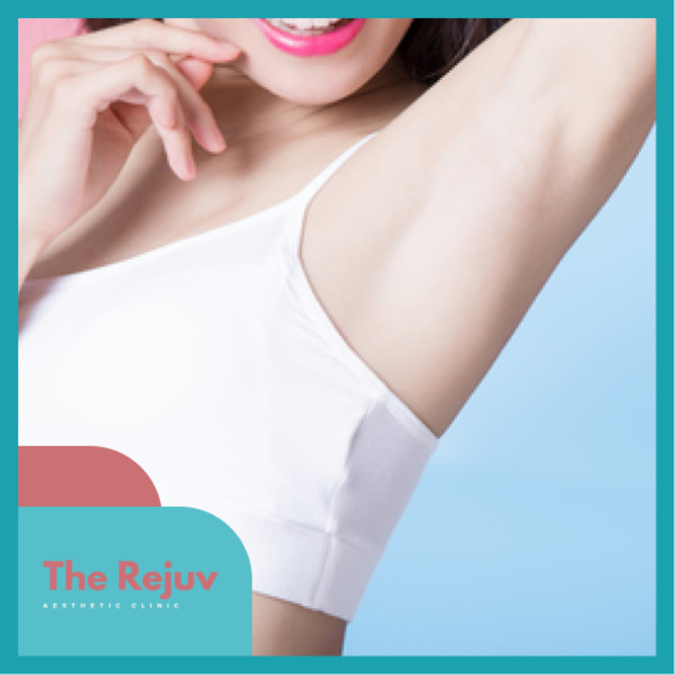 กำจัดขนรักแร้ ด้วยเครื่อง E-Max Syneron จากอเมริกา 1 ครั้ง ที่ The Rejuv Clinic