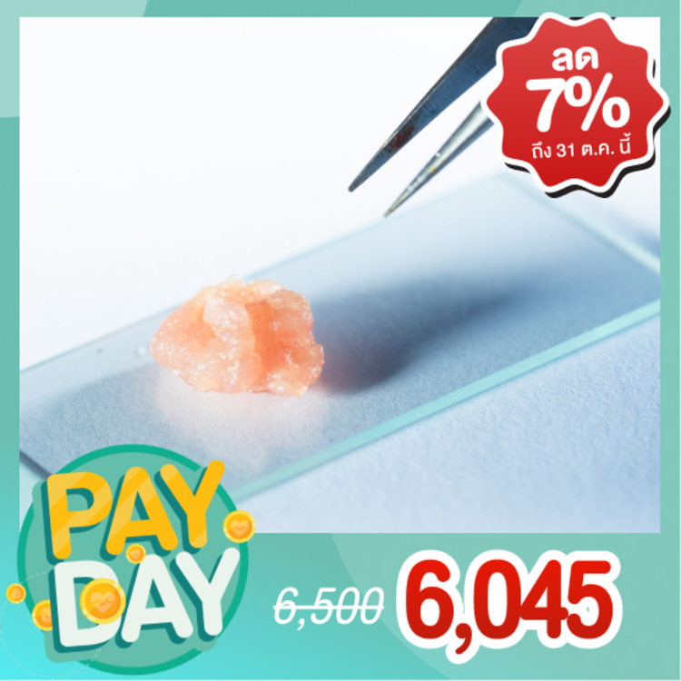 ตรวจคัดกรองสุขภาพจาก DNA 125 รายการ ที่ Thrive Wellness