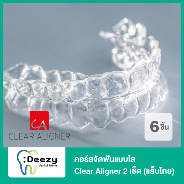 คอร์สจัดฟันแบบใส Clear Aligner 2 เซ็ต บนและล่าง (แล็บไทย) ที่ Deezy Dental Home