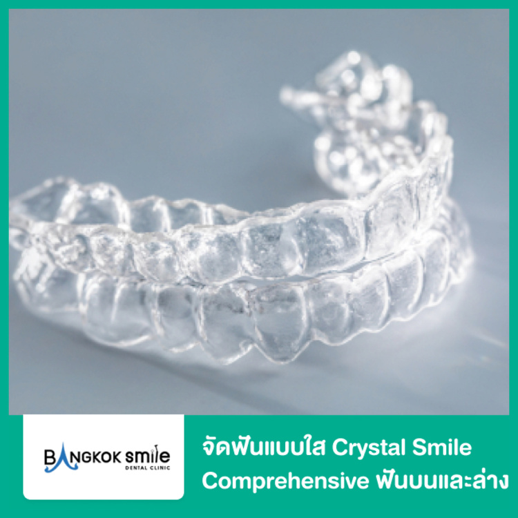 จัดฟันแบบใส Crystal Smile Comprehensive ฟันบนและล่าง ที่ Bangkok Smile Dental