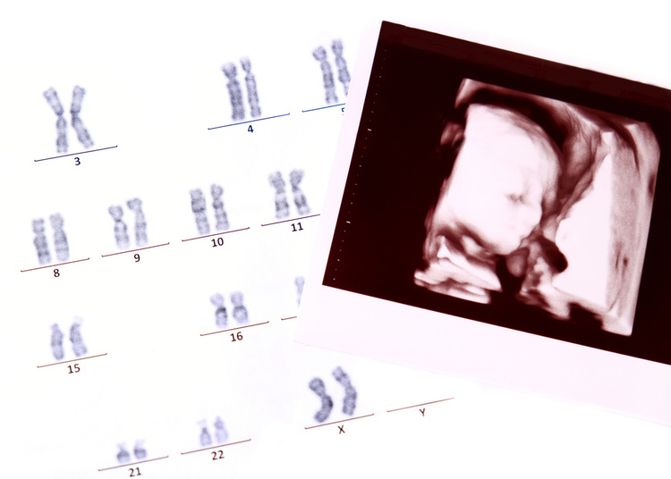 ตรวจ DNA ของทารกในครรภ์ (NIPT) ที่ Takara IVF Bangkok