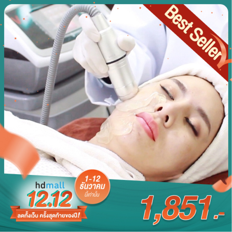 ทำ HIFU ด้วยเครื่อง V-Max HIFU 1,200 ช็อต บริเวณใบหน้า 1 ครั้ง ที่ Estella Clinic