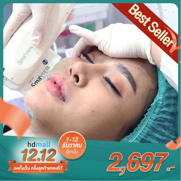 ทำ HIFU Smashthera 3 in 1 ไม่จำกัดช็อต บริเวณใบหน้ารวมเหนียง 1 ครั้ง ที่ Levince clinic