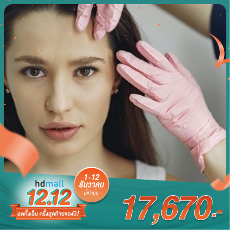 ฉีด Botulinum Toxin อเมริกา Allergan 100 ยูนิต เพื่อลดเลือนริ้วรอย ปรับรูปหน้า ที่ The Sign Clinic