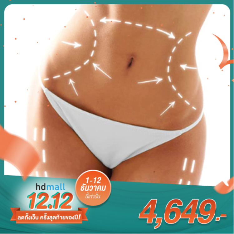สลายไขมันและยกกระชับบริเวณหน้าท้อง ด้วยเครื่อง Exilis Ultra 360 1 ครั้ง ที่ ID Life Clinic