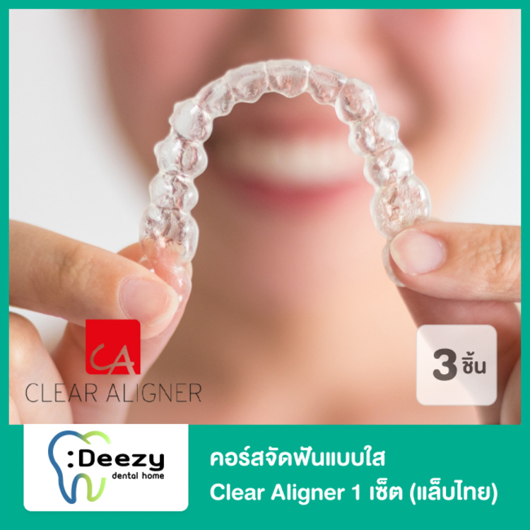 คอร์สจัดฟันแบบใส Clear Aligner 1 เซ็ต ฟันบนหรือล่าง (แล็บไทย) ที่ Deezy Dental Home