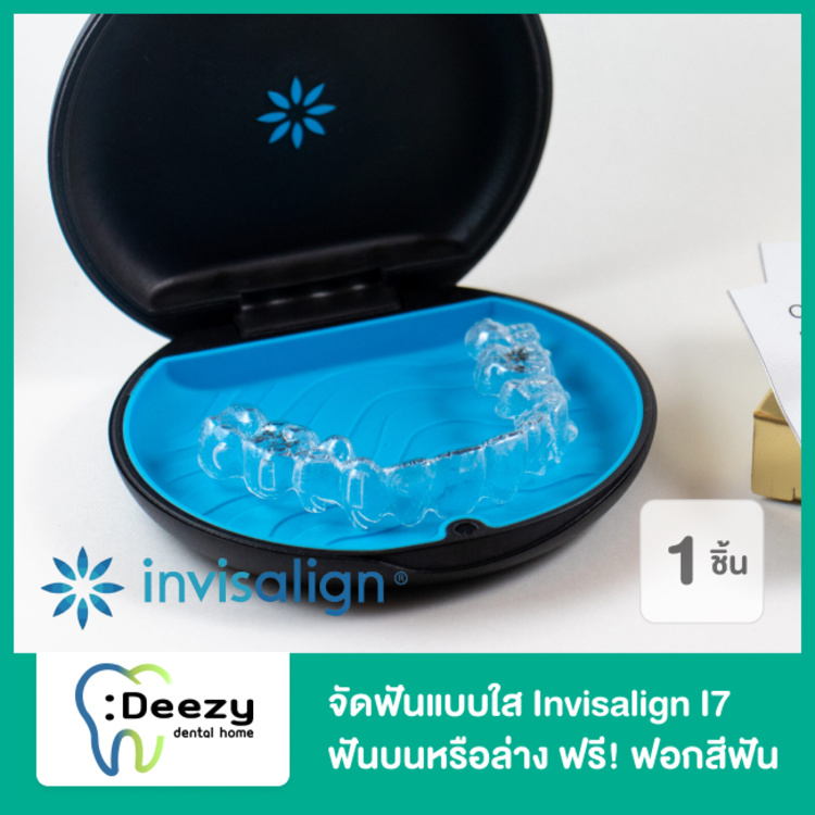จัดฟันแบบใส Invisalign i7 ฟันบนหรือล่าง ฟรี! ฟอกสีฟันที่คลินิก 1 ครั้ง ที่ Deezy Dental Home