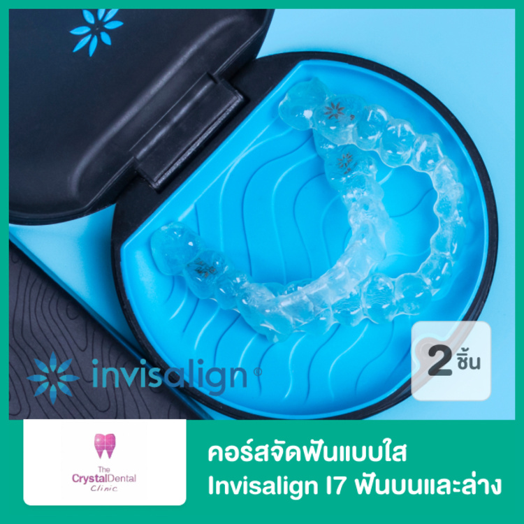 คอร์สจัดฟันแบบใส Invisalign i7 ฟันบนและล่าง ที่ The Crystal Dental Clinic