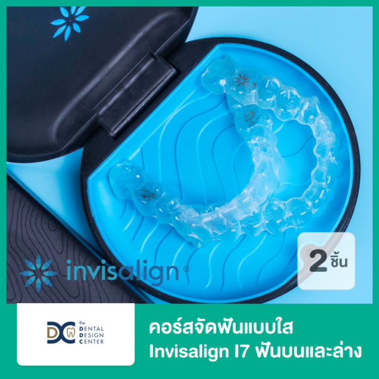 คอร์สจัดฟันแบบใส Invisalign i7 ฟันบนและล่าง ที่ Dental Design Center