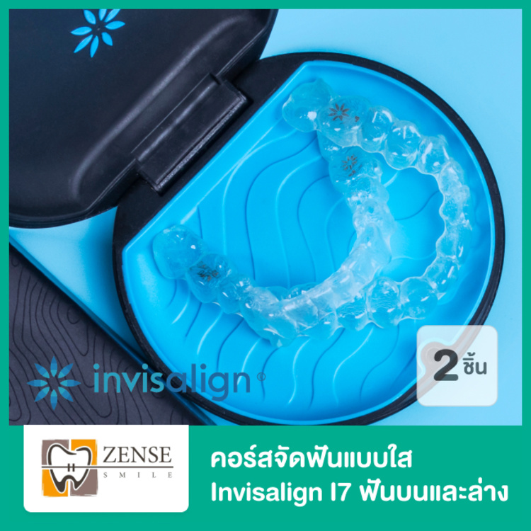 คอร์สจัดฟันแบบใส Invisalign i7 ฟันบนและล่าง ที่ Zense Smile