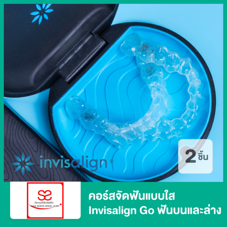 คอร์สจัดฟันแบบใส Invisalign Go ฟันบนและล่าง ที่ Asoke Montri Dental Clinic (อโศกมนตรีเด็นทัลคลินิก)