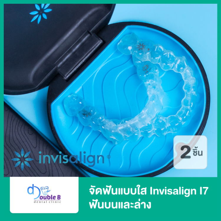 จัดฟันแบบใส Invisalign i7 ฟันบนและล่าง ที่ Double B Dental Clinic