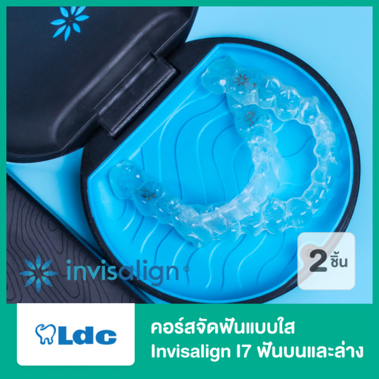 คอร์สจัดฟันแบบใส Invisalign i7 ฟันบนและล่าง ที่ LDC Dental