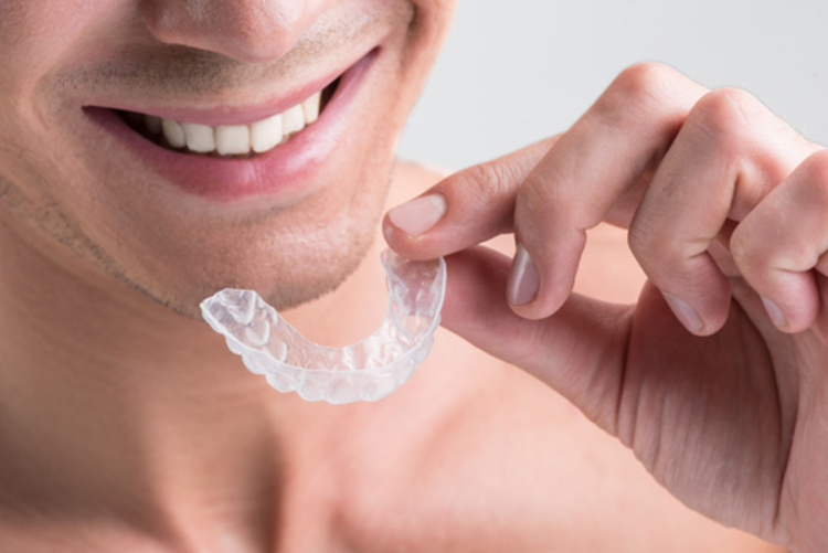 คอร์สจัดฟันแบบใส Invisalign Express ที่ Smile & Shine Dental (คลินิกทันตกรรมสไมล์แอนด์ชายน์)