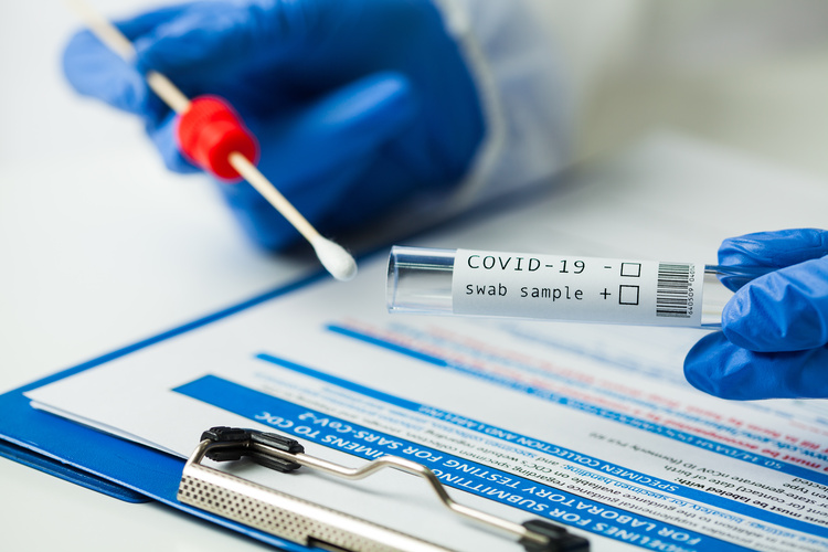 ตรวจหาเชื้อ COVID-19 เทคนิค Real time - PCR ที่ Wellmed Bangkok Clinic
