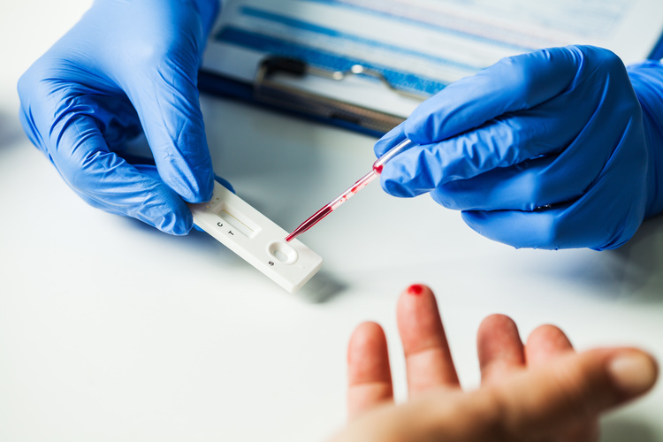 ตรวจหาภูมิคุ้มกัน COVID-19 ด้วยชุดทดสอบแบบรวดเร็ว (Rapid Test) ที่ โรงพยาบาลจุฬารัตน์ 3 อินเตอร์