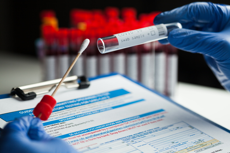 ตรวจหาเชื้อ COVID-19 เทคนิค Real time - PCR ที่ ATGenes