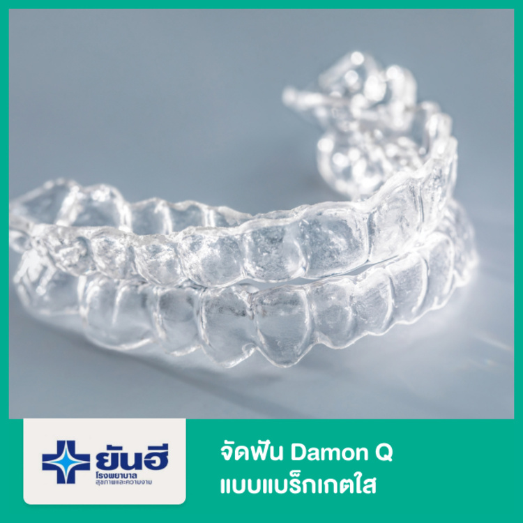 จัดฟัน Damon Q แบบแบร็กเกตใส ที่ โรงพยาบาลยันฮี