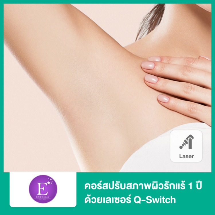 คอร์สปรับสภาพผิวรักแร้ ด้วยเลเซอร์ Q-Switch 1 ปี (สูงสุด 12 ครั้ง) ที่ Estella Clinic