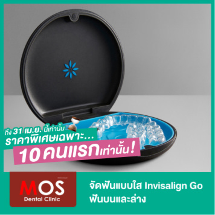จัดฟันแบบใส Invisalign Go ฟันบนและล่าง ที่ MOS Dental Clinic