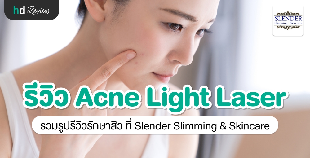 รีวิว รักษาสิว ด้วย Acne Light Laser ที่ Slender Slimming & Skincare