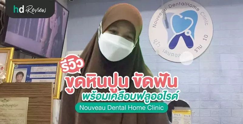 รีวิว ขูดหินปูน ขัดฟัน พร้อมเคลือบฟลูออไรด์ ที่ Nouveau Dental Home Clinic